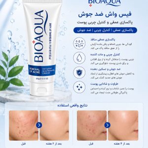 فیس واش ضد جوش بیواکوا 00057